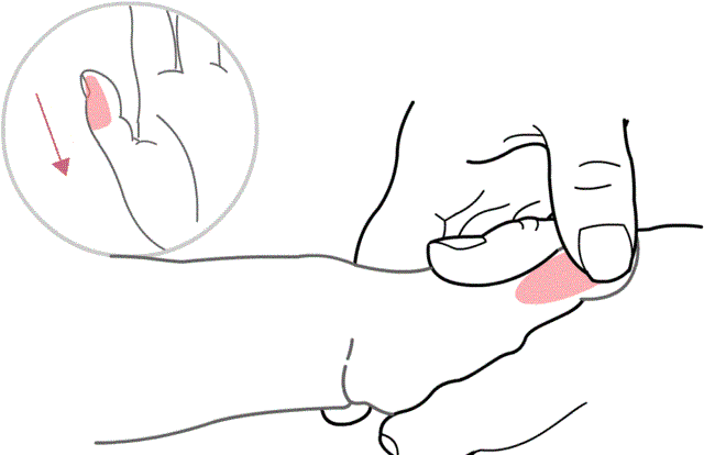 小孩反复发烧小妙招(小孩发烧有什么妙招)(图5)